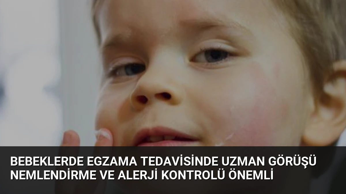 Bebeklerde Egzama Tedavisinde Uzman Görüşü Nemlendirme ve Alerji Kontrolü Önemli