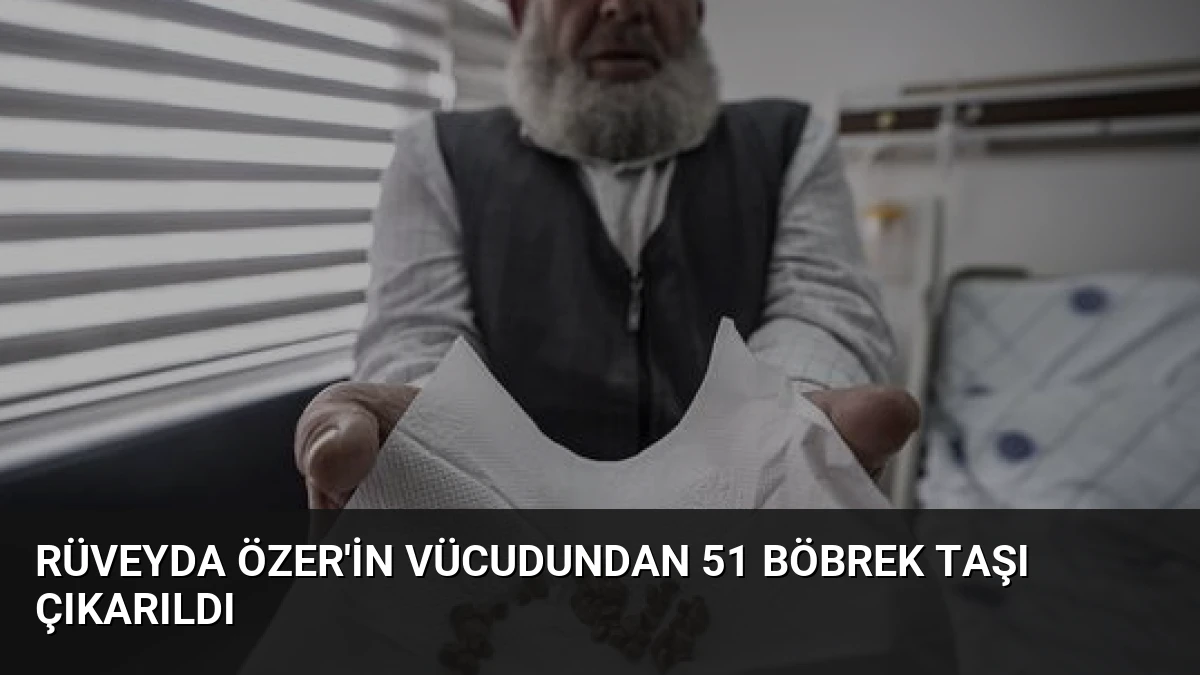 Rüveyda Özer’in Vücudundan 51 Böbrek Taşı Çıkarıldı