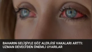 Baharın gelişiyle göz alerjisi vakaları arttı: Uzman Deveci’den önemli uyarılar