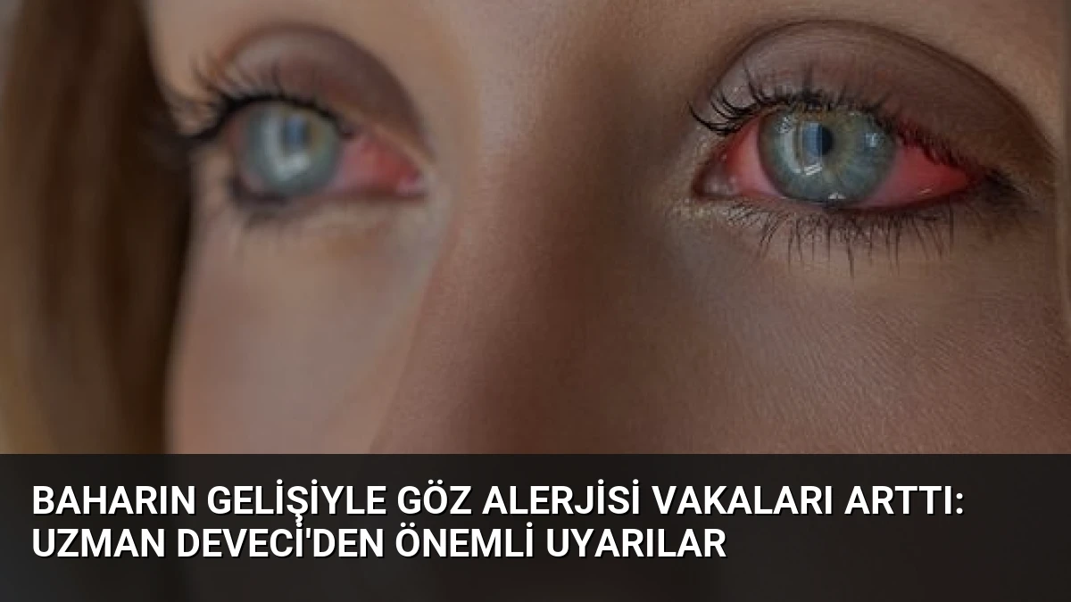 Baharın gelişiyle göz alerjisi vakaları arttı: Uzman Deveci’den önemli uyarılar